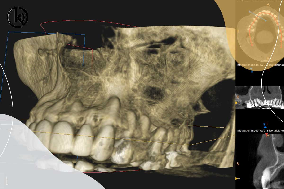 اسکن فک فرمانیه